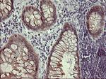 IFNGR2 Antibody in Immunohistochemistry (Paraffin) (IHC (P))