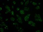 IFT57 Antibody in Immunocytochemistry (ICC/IF)