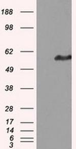 IFT57 Antibody in Western Blot (WB)