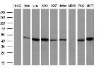 IFT57 Antibody in Western Blot (WB)