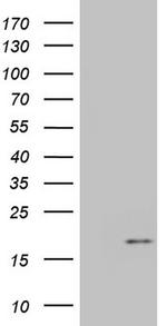 IGF1 Antibody in Western Blot (WB)