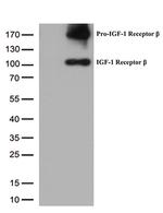 IGF1R Antibody in Western Blot (WB)