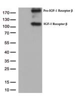 IGF1R Antibody in Western Blot (WB)