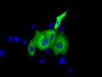 IGF2BP2 Antibody in Immunocytochemistry (ICC/IF)