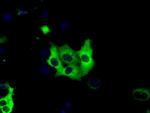 IGF2BP2 Antibody in Immunocytochemistry (ICC/IF)