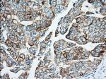 IGF2BP2 Antibody in Immunohistochemistry (Paraffin) (IHC (P))