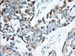 IGF2BP2 Antibody in Immunohistochemistry (Paraffin) (IHC (P))