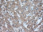 IGF2BP2 Antibody in Immunohistochemistry (Paraffin) (IHC (P))