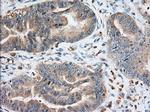 IGF2BP2 Antibody in Immunohistochemistry (Paraffin) (IHC (P))