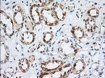 IGF2BP2 Antibody in Immunohistochemistry (Paraffin) (IHC (P))