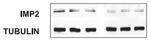 IGF2BP2 Antibody in Western Blot (WB)