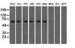 IGF2BP2 Antibody in Western Blot (WB)