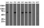 IGF2BP2 Antibody in Western Blot (WB)