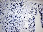 IGF2BP3 Antibody in Immunohistochemistry (Paraffin) (IHC (P))