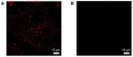 IGF2R Antibody in Immunocytochemistry (ICC/IF)