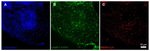 IGF2R Antibody in Immunocytochemistry (ICC/IF)