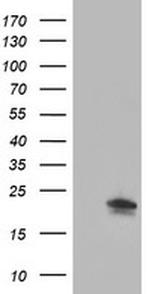 IGJ Antibody in Western Blot (WB)