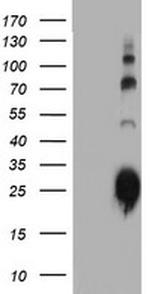 IGJ Antibody in Western Blot (WB)