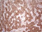 IGSF11 Antibody in Immunohistochemistry (Paraffin) (IHC (P))