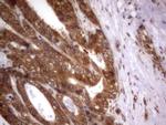 IGSF11 Antibody in Immunohistochemistry (Paraffin) (IHC (P))