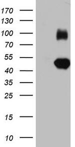 IGSF11 Antibody in Western Blot (WB)