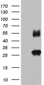 IGSF11 Antibody in Western Blot (WB)