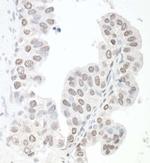 SMC6 Antibody in Immunohistochemistry (IHC)