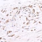 BRD2 Antibody in Immunohistochemistry (Paraffin) (IHC (P))