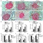 Ki-67 Antibody in Immunohistochemistry (IHC)