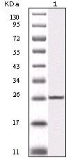 IKK beta Antibody in Western Blot (WB)