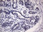 IKBKE Antibody in Immunohistochemistry (Paraffin) (IHC (P))