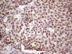 IKBKE Antibody in Immunohistochemistry (Paraffin) (IHC (P))