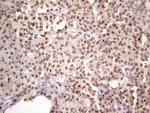 IKBKE Antibody in Immunohistochemistry (Paraffin) (IHC (P))