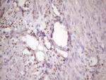 IKBKE Antibody in Immunohistochemistry (Paraffin) (IHC (P))