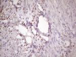 IKBKE Antibody in Immunohistochemistry (Paraffin) (IHC (P))