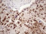 IKBKE Antibody in Immunohistochemistry (Paraffin) (IHC (P))