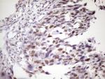 IKBKE Antibody in Immunohistochemistry (Paraffin) (IHC (P))