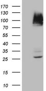 IKBKE Antibody in Western Blot (WB)