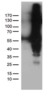 IKBKG Antibody in Western Blot (WB)