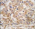 IKK epsilon Antibody in Immunohistochemistry (IHC)