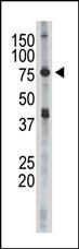 IKK epsilon Antibody in Western Blot (WB)