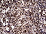 IKZF3 Antibody in Immunohistochemistry (Paraffin) (IHC (P))