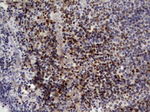 IKZF3 Antibody in Immunohistochemistry (Paraffin) (IHC (P))