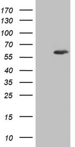 IKZF3 Antibody in Western Blot (WB)