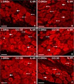 IL-6 Antibody in Immunohistochemistry (IHC)