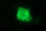 IL10RA Antibody in Immunocytochemistry (ICC/IF)