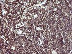 IL10RA Antibody in Immunohistochemistry (Paraffin) (IHC (P))