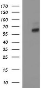 IL10RA Antibody in Western Blot (WB)