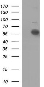 IL10RA Antibody in Western Blot (WB)