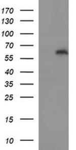 IL10RA Antibody in Western Blot (WB)